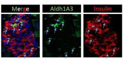 Immunohistochemistry-Frozen: ALDH1A3 Antibody - BSA Free [NBP2-15339]