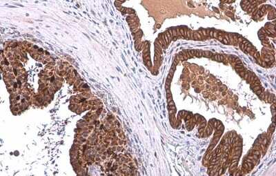 Immunohistochemistry-Paraffin: ALDH1A3 Antibody - BSA Free [NBP2-15339]
