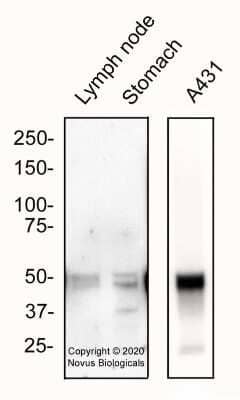 Western Blot: ALDH1A3 AntibodyBSA Free [NBP2-15339]