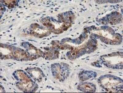 Immunohistochemistry: ALDH1A3 Antibody (OTI4E8) [NBP2-46510]