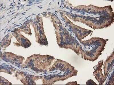 Immunohistochemistry: ALDH1A3 Antibody (OTI4E8) [NBP2-46510]