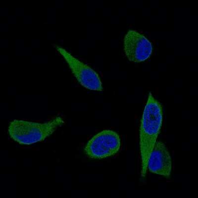 Immunocytochemistry/ Immunofluorescence: ALDH1A3 Antibody (CL11968) [NBP3-15126]