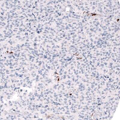 Immunohistochemistry-Paraffin: ALDH1A3 Antibody (CL11968) [NBP3-15126]