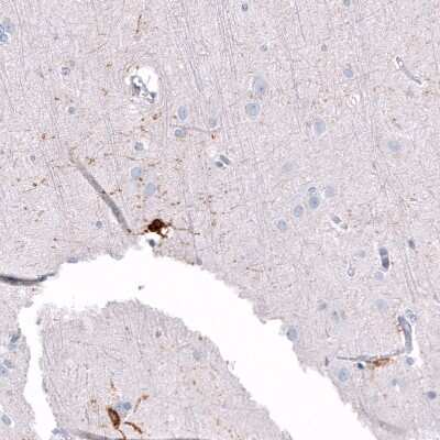 Immunohistochemistry-Paraffin: ALDH1A3 Antibody (CL11968) [NBP3-15126]
