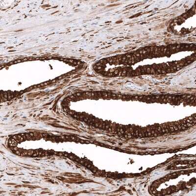 Immunohistochemistry-Paraffin: ALDH1A3 Antibody (CL11968) [NBP3-15126]