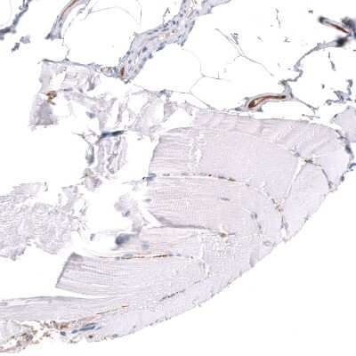 Immunohistochemistry-Paraffin: ALDH1A3 Antibody (CL11968) [NBP3-15126]