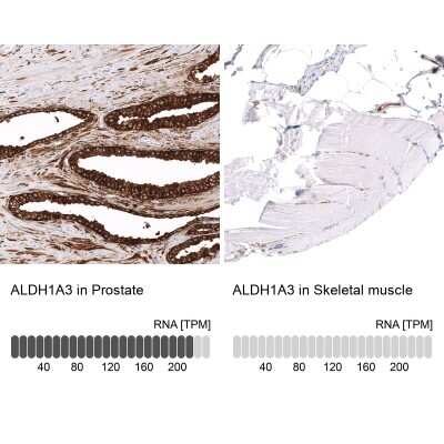 Immunohistochemistry-Paraffin: ALDH1A3 Antibody (CL11968) [NBP3-15126]