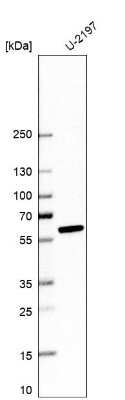 Western Blot: ALDH1A3 Antibody (CL11968) [NBP3-15126]