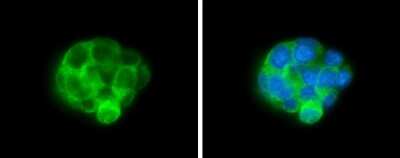 Immunocytochemistry/ Immunofluorescence: ALDH1A3 Antibody (GT926) [NBP3-13570]