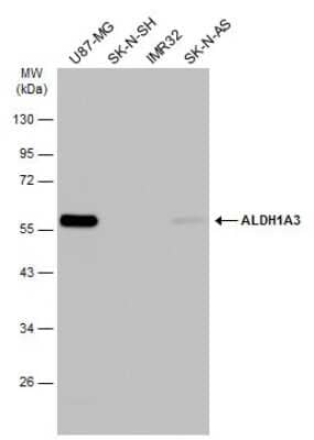 Western Blot: ALDH1A3 Antibody (GT926) [NBP3-13570]