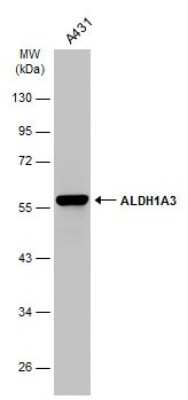 Western Blot: ALDH1A3 Antibody (GT926) [NBP3-13570]