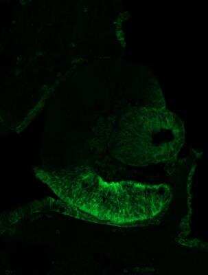 Immunohistochemistry-Frozen: ALDH1A3 Antibody [NBP1-91657]