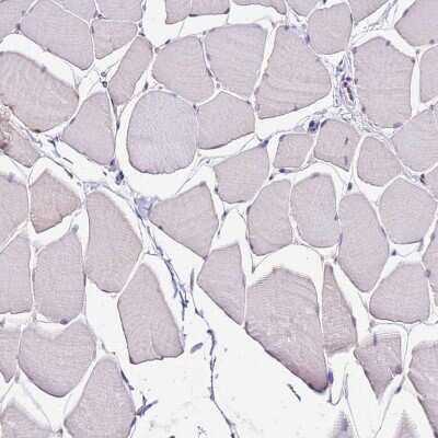 Immunohistochemistry-Paraffin: ALDH1A3 Antibody [NBP1-91657]