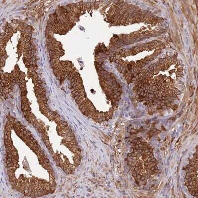 Immunohistochemistry-Paraffin: ALDH1A3 Antibody [NBP1-91657]