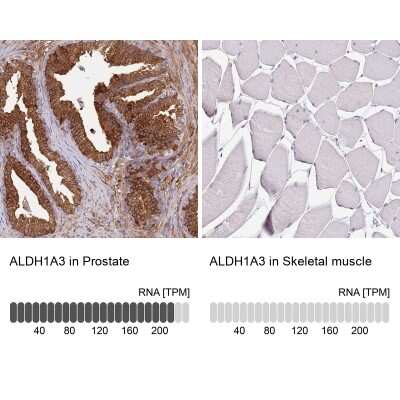 Immunohistochemistry-Paraffin: ALDH1A3 Antibody [NBP1-91657]