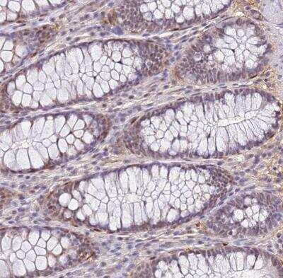 Immunohistochemistry-Paraffin: ALDH1A3 Antibody [NBP1-91657]