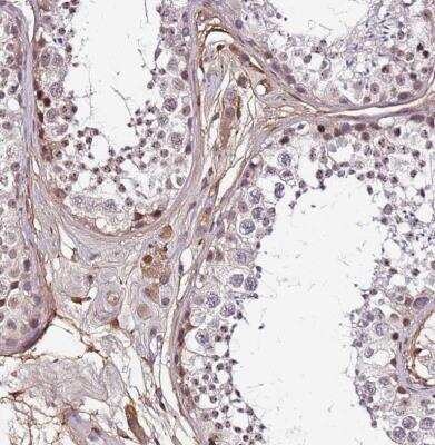 Immunohistochemistry-Paraffin: ALDH1A3 Antibody [NBP1-91657]