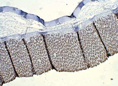 Immunohistochemistry-Paraffin: ALDH1A3 Antibody [NBP3-12280]