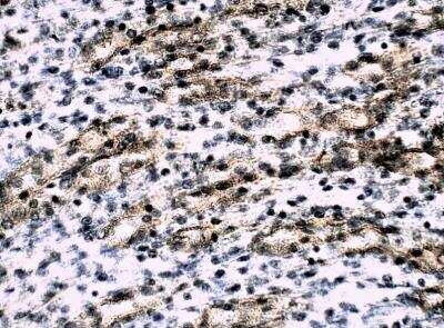 Immunohistochemistry-Paraffin: ALDH1A3 Antibody [NBP3-12280]