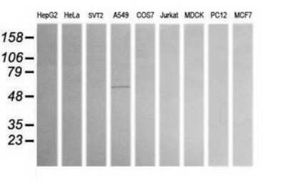 Western Blot: ALDH1A3 Antibody (OTI4E8)Azide and BSA Free [NBP2-70154]