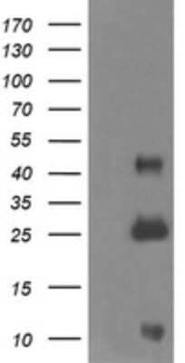 Western Blot: ALDH1A3 Antibody (OTI4E8)Azide and BSA Free [NBP2-70154]