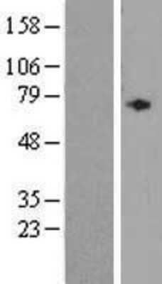 Western Blot: ALDH1A3 Overexpression Lysate [NBL1-07453]