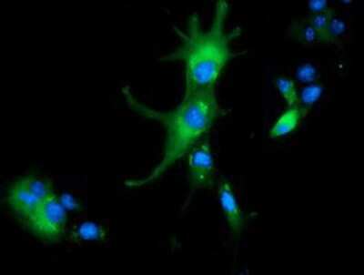 Immunocytochemistry/ Immunofluorescence: ALDH1L1 Antibody (OTI3D2) [NBP2-03143]