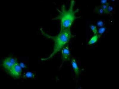 Immunocytochemistry/ Immunofluorescence: ALDH1L1 Antibody (OTI3D2) - Azide and BSA Free [NBP2-71629]