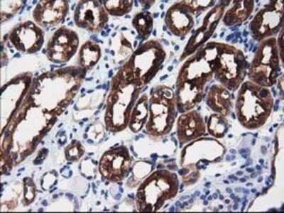 Immunohistochemistry: ALDH1L1 Antibody (OTI3D2) - Azide and BSA Free [NBP2-71629]
