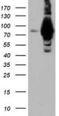 Western Blot: ALDH1L1 Antibody (OTI3D2)Azide and BSA Free [NBP2-71629]