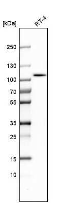 Western Blot: ALDH1L1 Antibody [NBP1-89414]