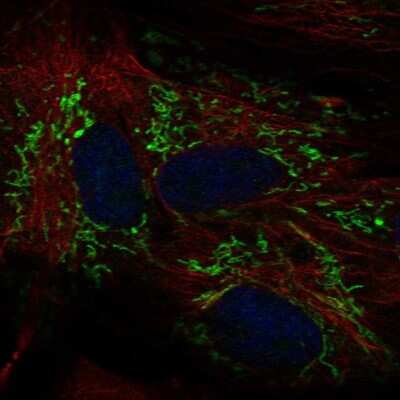 Immunocytochemistry/ Immunofluorescence: ALDH1L2 Antibody [NBP2-68750]