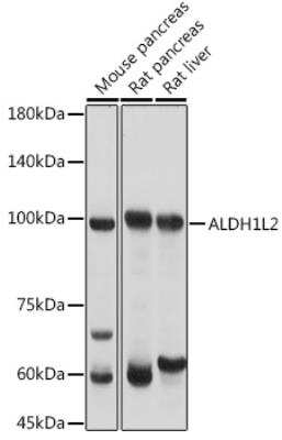 Western Blot: ALDH1L2 AntibodyAzide and BSA Free [NBP2-92166]