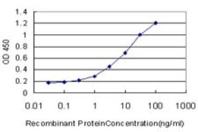 ELISA: ALDH2 Antibody (1E5) [H00000217-M01]