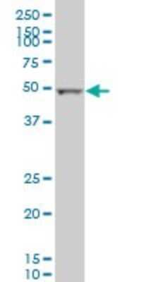 Western Blot: ALDH2 Antibody (1E5) [H00000217-M01]