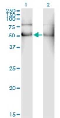 Western Blot: ALDH2 Antibody (1E5) [H00000217-M01]