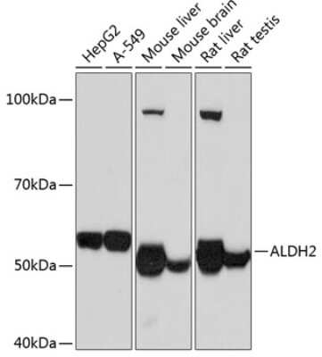 Western Blot: ALDH2 Antibody (1J9I8) [NBP3-15395]