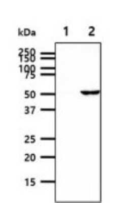 Western Blot: ALDH2 Antibody (2C10)BSA Free [NBP2-59488]