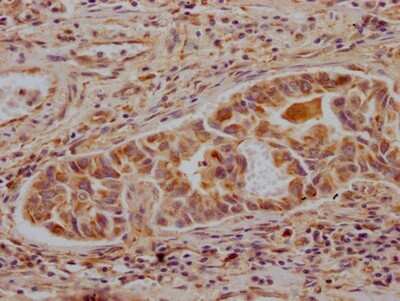 Immunohistochemistry: ALDH2 Antibody (3F10) [NBP3-15140]