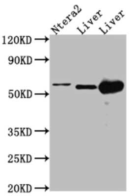 Western Blot: ALDH2 Antibody (3F10) [NBP3-15140]