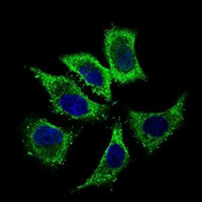 Immunocytochemistry/ Immunofluorescence: ALDH2 Antibody (4G6A3) - BSA Free [NBP2-37397]