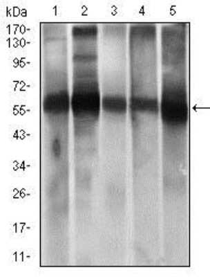 Western Blot: ALDH2 Antibody (4G6A3)BSA Free [NBP2-37397]