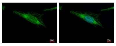 Immunocytochemistry/ Immunofluorescence: ALDH2 Antibody [NBP1-31749]