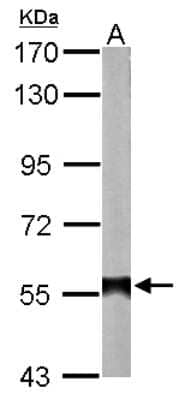 Western Blot: ALDH2 Antibody [NBP1-31749]