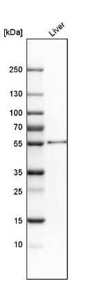 Western Blot: ALDH2 Antibody [NBP2-14280]