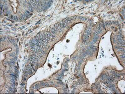 Immunohistochemistry-Paraffin: Aldehyde Dehydrogenase 3-A1/ALDH3A1 Antibody (OTI1B6) [NBP2-02483]