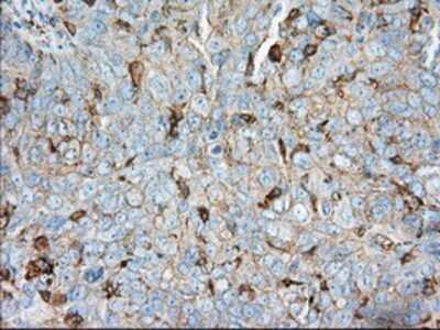 Immunohistochemistry-Paraffin: Aldehyde Dehydrogenase 3-A1/ALDH3A1 Antibody (OTI1B6) [NBP2-02483]