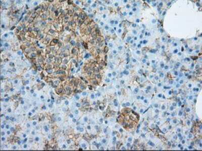 Immunohistochemistry-Paraffin: Aldehyde Dehydrogenase 3-A1/ALDH3A1 Antibody (OTI1B6) [NBP2-02483]