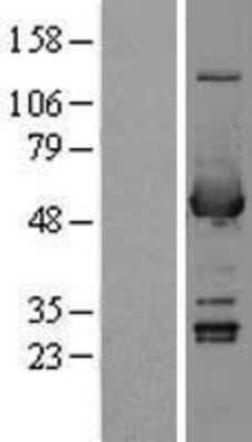 Western Blot: Aldehyde Dehydrogenase 3-A1/ALDH3A1 Overexpression Lysate [NBL1-07455]