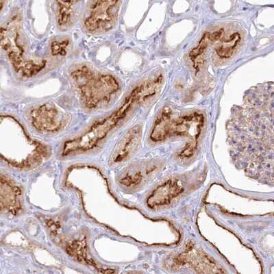 Immunohistochemistry-Paraffin: ALDH3B1 Antibody [NBP2-32638]